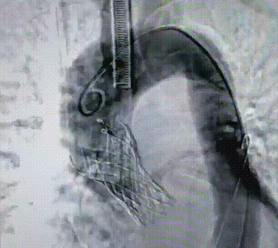 640_wx_fmt=gif&from=appmsg&tp=webp&wxfrom=10005&wx_lazy=1 (2).gif