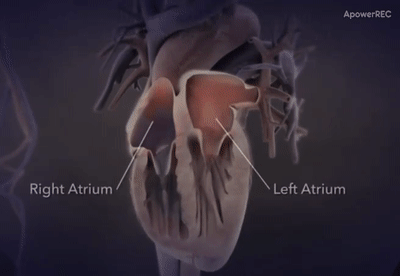 右心房（right atrium）左心房（left atrium）