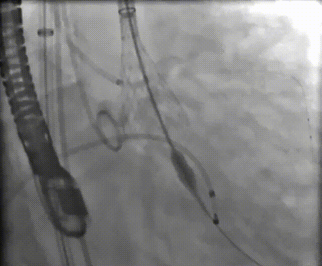 9.gif