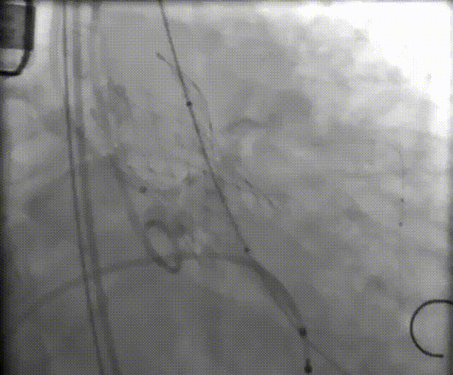 10.gif