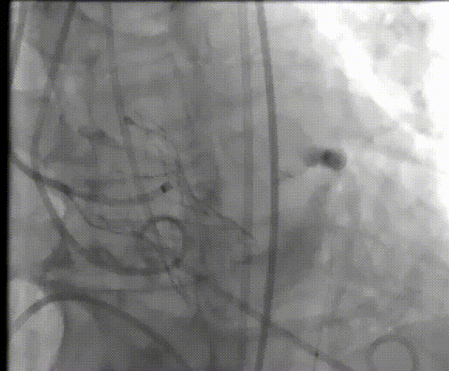 11.gif