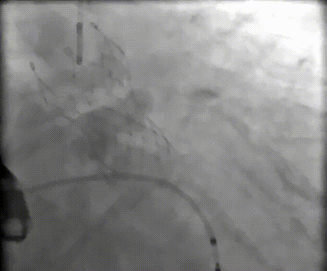 12.gif