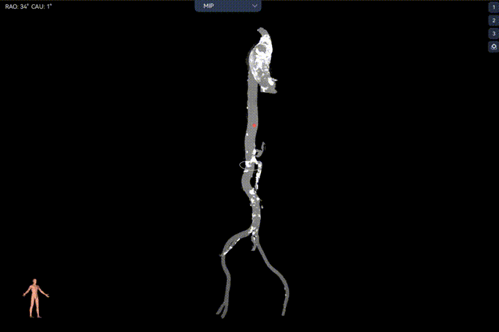 11.gif