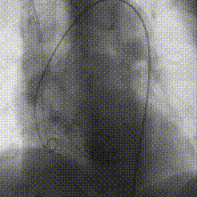 13.gif