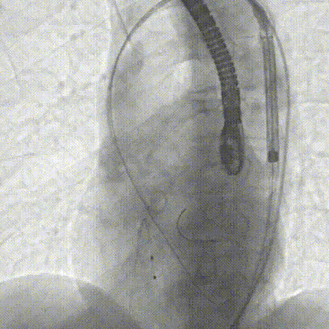 6.gif