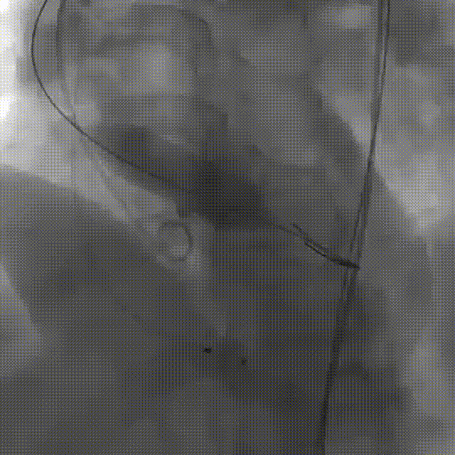 5.gif