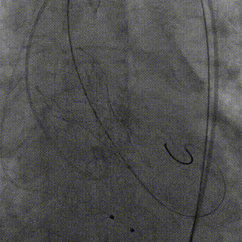 9.gif