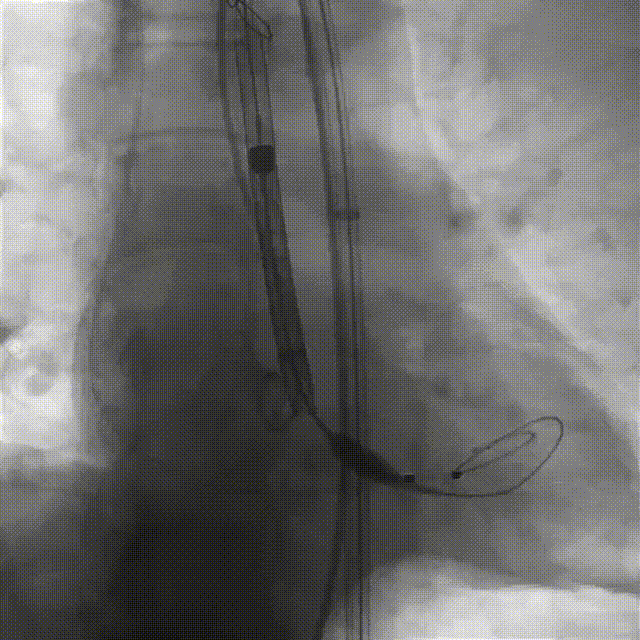 8.gif