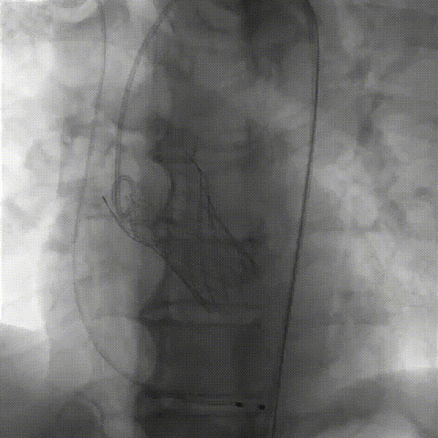 10.gif