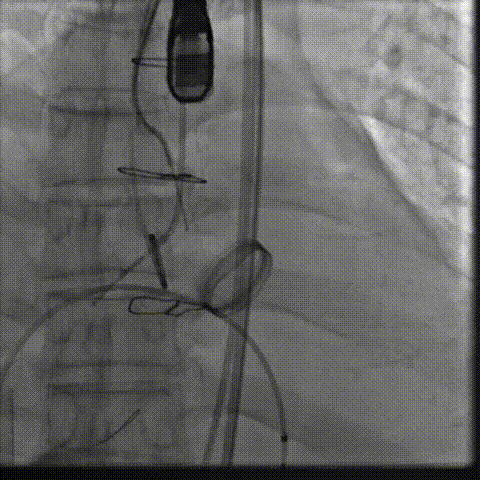 6.gif