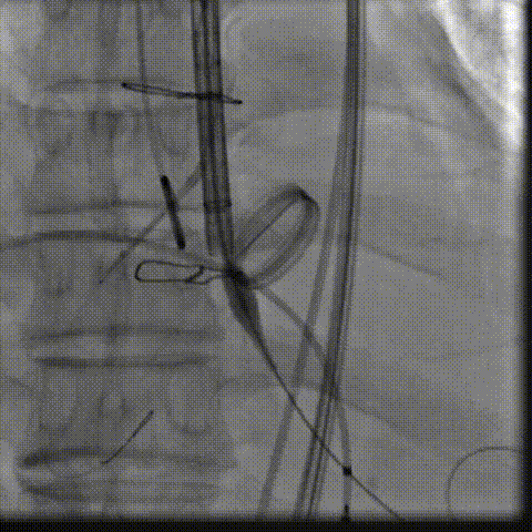 7.gif