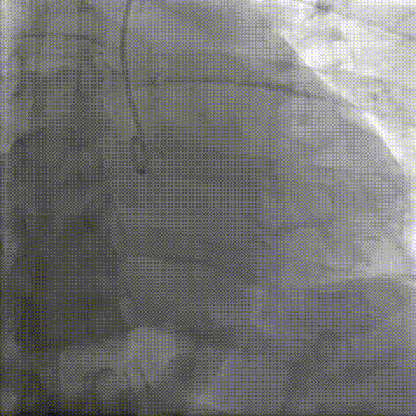 5.gif