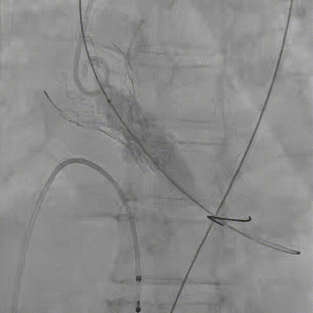 11.gif