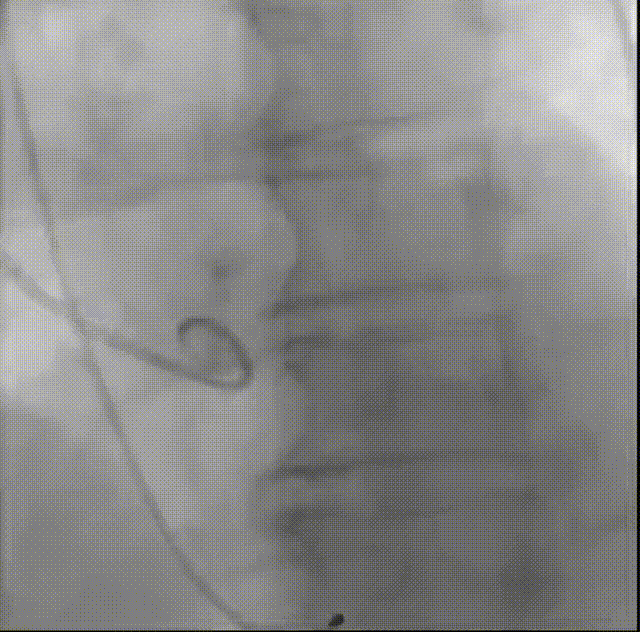 7.gif