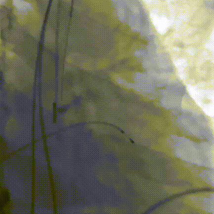 6.gif